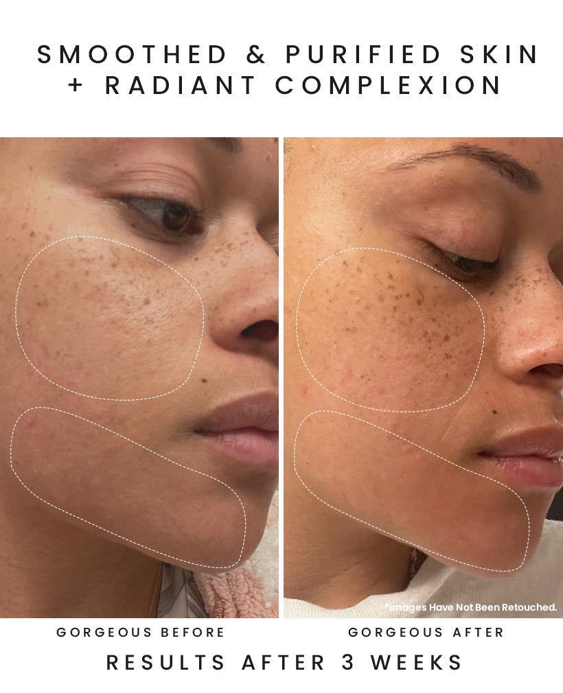 SUNSHINE DEW Antioxidant Cleansing Oil